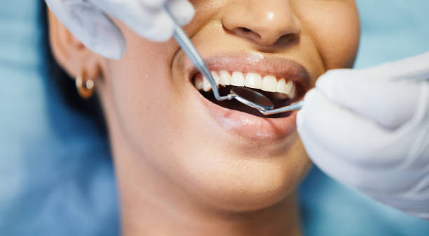 Best Broken or Chipped Tooth Repair in Denison, TX
