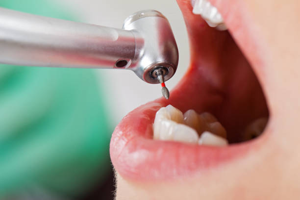 Best Emergency Dental Care for Sports Injuries in Denison, TX
